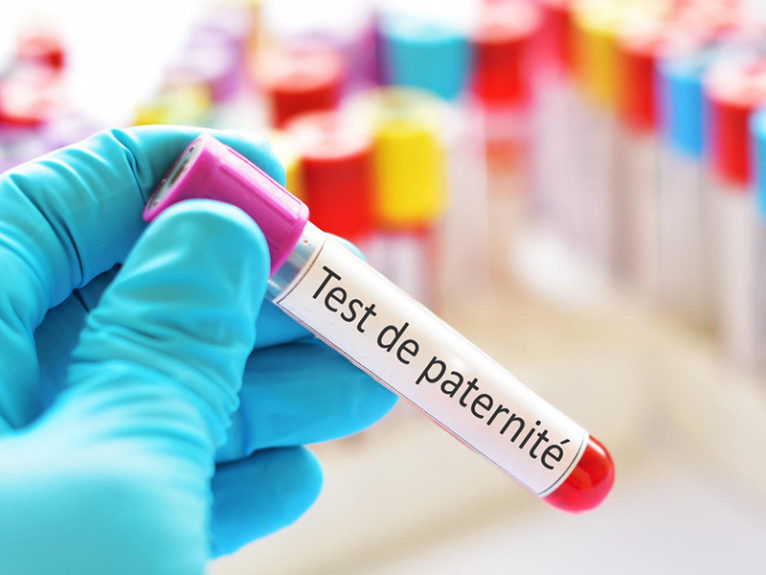 Comment faire un test de paternité ? Agencenourrices Comment faire un test de paternité ? Agencenourrices